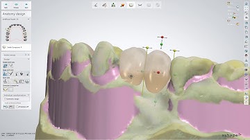 3DBioCAD - 3Shape Dental System How to design flexible partial dentures