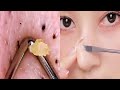Asian Makeup Tutorials Compilation | New Makeup 2021 | 美しいメイクアップ/ part 103