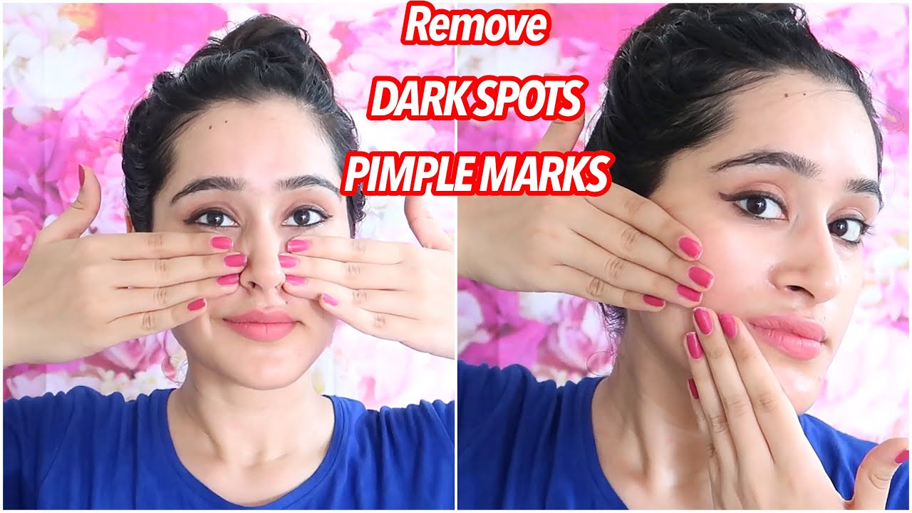 OMG 😯 this Facial Removes PIMPLE MARKS , DARK SPOTS in 3 Days | Remove