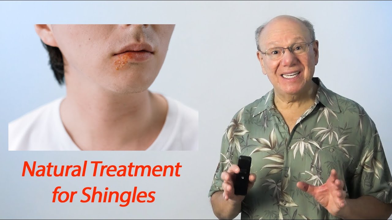 Natural Treatment For Shingles YouTube Natural treatment for shingles youtube