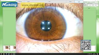 Software de Iridologia Maikong 2025 | Tutorial | 1080p