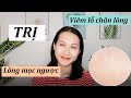 Trị Viêm Nang Chân Lông - Lông Mọc Ngược An Toàn Và Hiệu Quả Tại Nhà | CHLOE DO