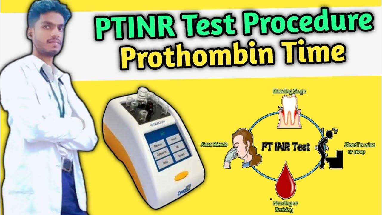pt inr test ProcedureProthrombin time testlaboratory medical 