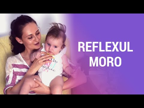 Video: Reflexul Startle La Bebeluși: Cât Durează?