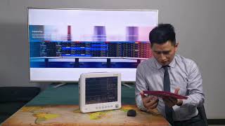 Why Patient Monitor Is Important For The Treatment Of COVID-19 Patient? Why Patient Monitor Is Important For The Treatment Of COVID-19 Patient?