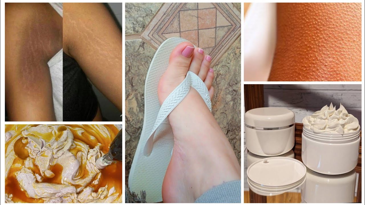 wad kaganacsan karta,karemka jirka madmadowga kasaro 😱 body lotion moisturiser and whitening