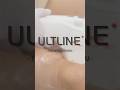 [For Export] ULTLINE (forearm) #EunsungGlobal #ULTLINE