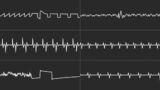 COMMODORE C64 SID 2023 - R TYPE AMIGA 2 SID - JASON PAGE - 6 CHANNEL MONO TUNE / Oscilloscope View