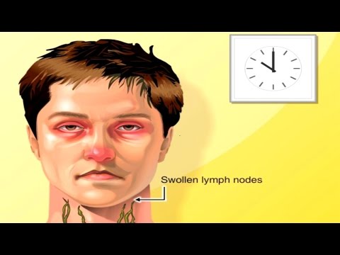 Video: Kako natiču limfni čvorovi?