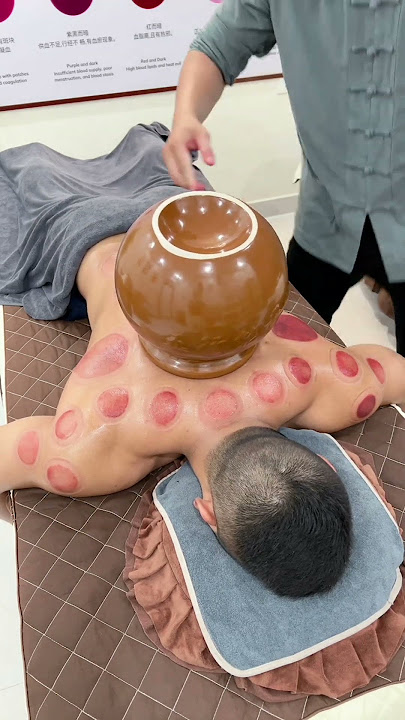 You should not inhale when opening a cupping cups #asmr #cuppingtherapy #youtubeshorts #relax #china