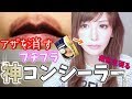 【プチプラ】アザが消えた！こんなに優秀な神コンシーラーがあったなんて！【ドラックストア】