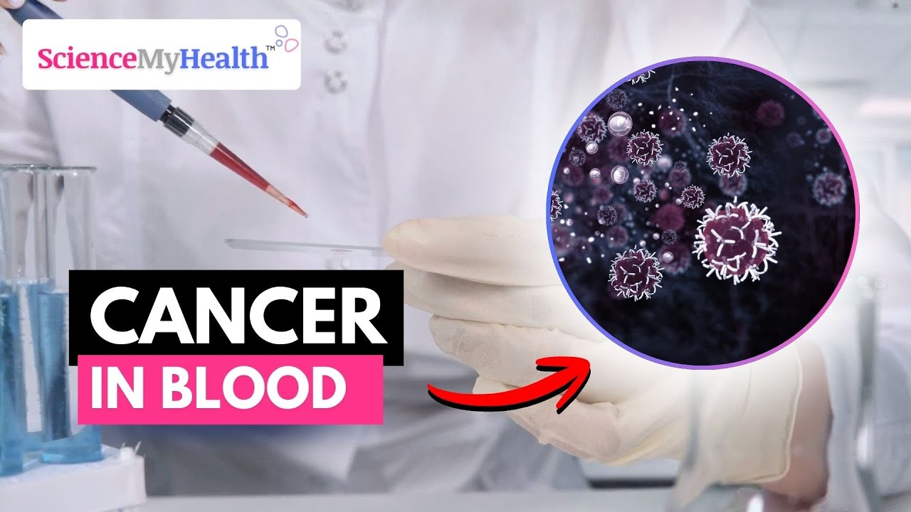 New Research Breakthrough Shows that a Blood Test May Spot Cancer Before Symptoms