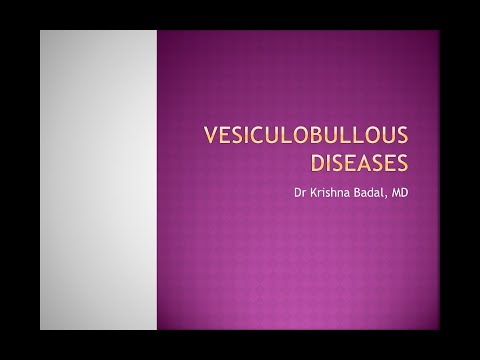 Pemphigus, Bullous pemphigoid and dermatitis herpetiformis