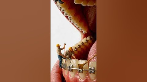 Amazing Mini Workers on Teeth  #funny #digitalart #comedy #ai