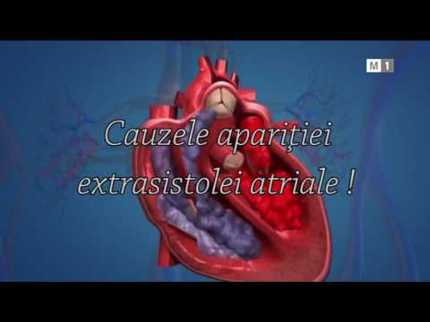Video: Extrasistola - Cauze și Simptome Ale Extrasistolei, Diagnosticului și Prevenirii