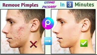 S A TECH CREATION - தமிழ் 1st video | how to get rid of pimples in photos | In Picsart | Tamil screenshot 3