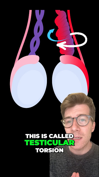 Testicular torsion - 5 Symptoms #shorts
