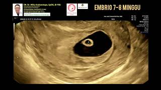 Embrio 7-8 minggu
