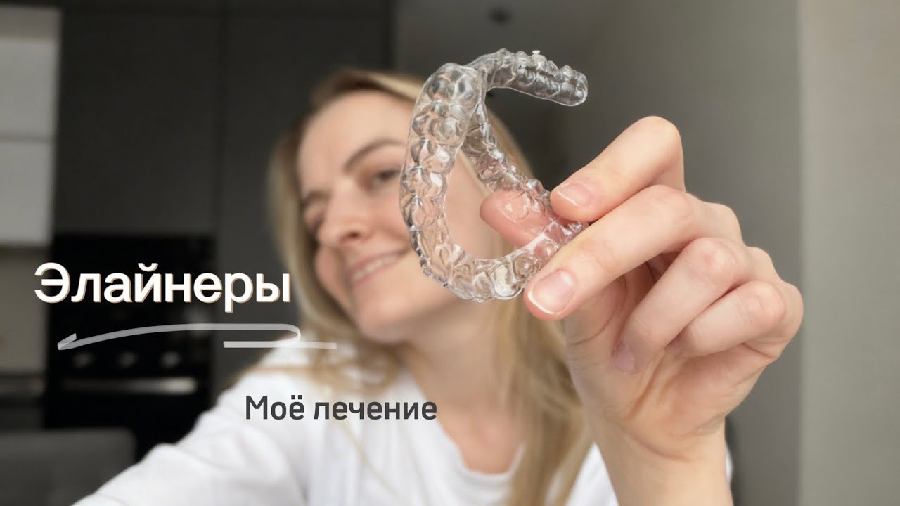 Болтаем про ЭЛАЙНЕРЫ | Моя история лечения зубов