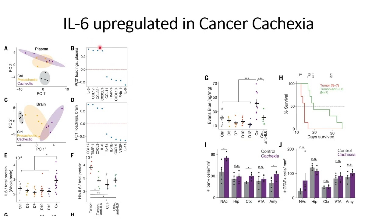 IL-6 upregulated in cancer- Cachexia condition (wasting syndrome) 