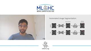 ID 140: A Deep Learning Based Framework for Joint Image Registration and Segmentation of Brain Me...