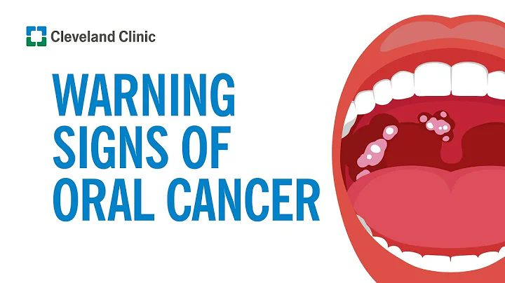 How to Screen Yourself for Oral Cancer - DayDayNews