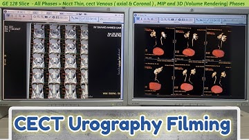 CECT Urography Filming | Ncct and Cect Phase | By Anis Qureshi