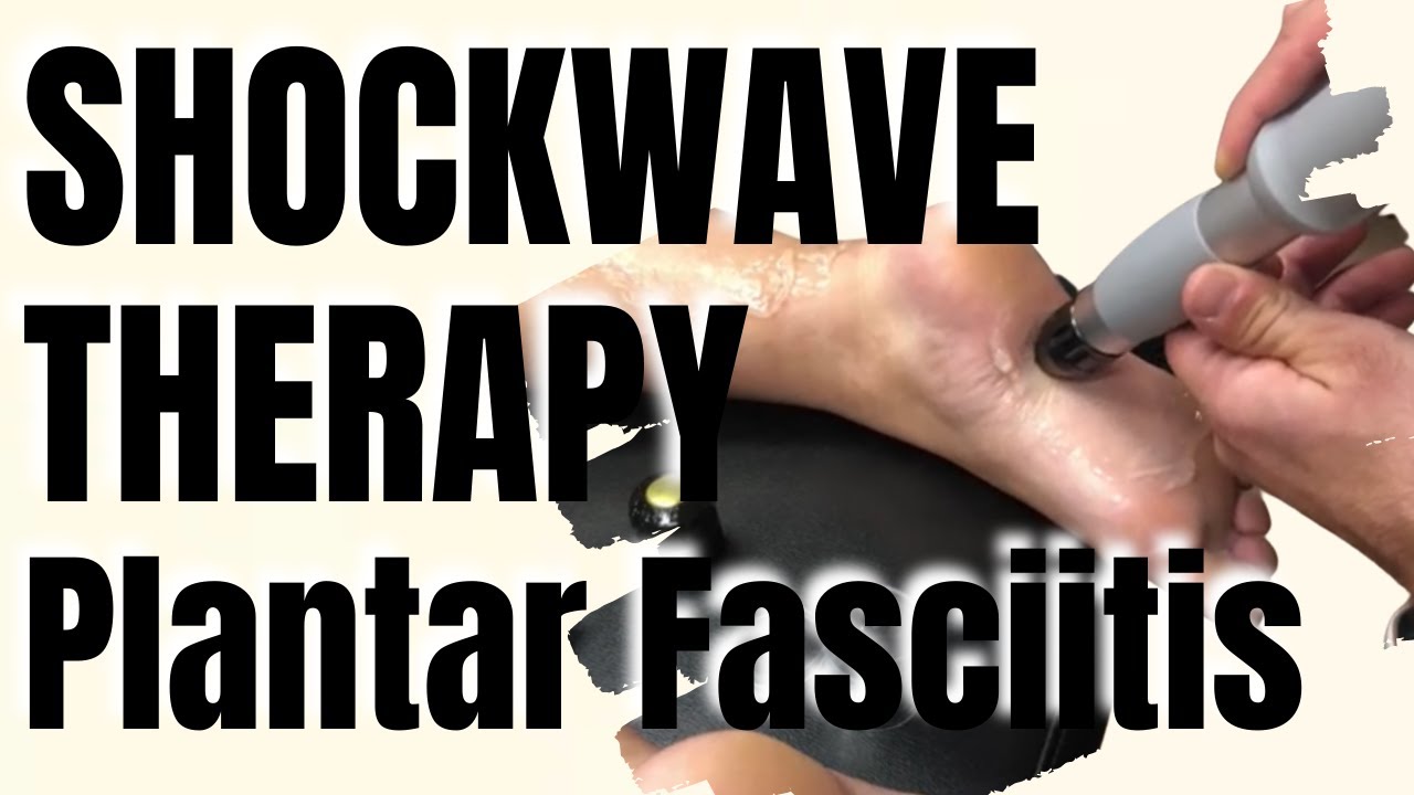 Shockwave Therapy for Plantar Fasciitis, San Diego Shockwave Clinic