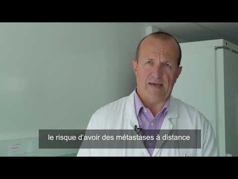 Vidéo: Les Taux De Facteur De Croissance Transformant Bêta 1 Prédisent Des Changements échocardiographiques à Trois Ans Après La Radiothérapie Adjuvante Pour Le Cancer Du Sein