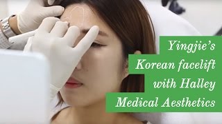 Yingjie Of Myfatpocket Documents Her Korean Facelift Experience With Halley Medical Aesthetics