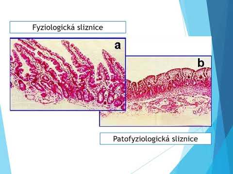 CHV08: Celiakie, fenylketonurie, diabetes mellitus