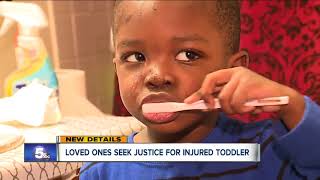 Family demands Cleveland police step up investigation after three-year-old is injured in hit-and-run