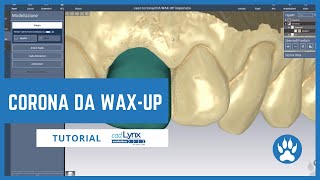 Wax-up con Cad Lynx Evolution