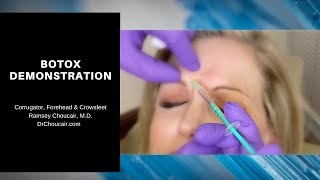 Botox® Demonstration: Corrugators, Forehead & Crowsfeet | Ramsey Choucair, MD. | Ph: 214-389-9797