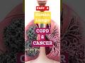 How Smoking Causes Lung Cancer? | Lungs Ka Andar Ka Sach #smokingawareness #facts #medical