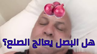 هل عصير البصل يعالج الصلع الوراثي ؟