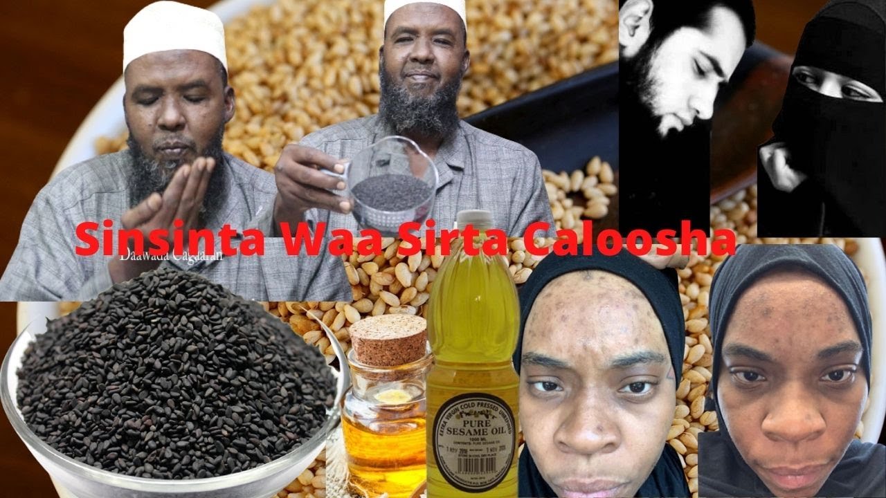 50 Xannuun Isaga Dawee SINSINTA Farxada Lamaanaha,Dhiga Gabdhaha