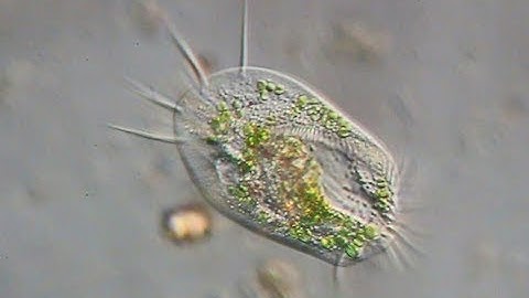An hypotrich ciliate from a pond - Euplotes sp.
