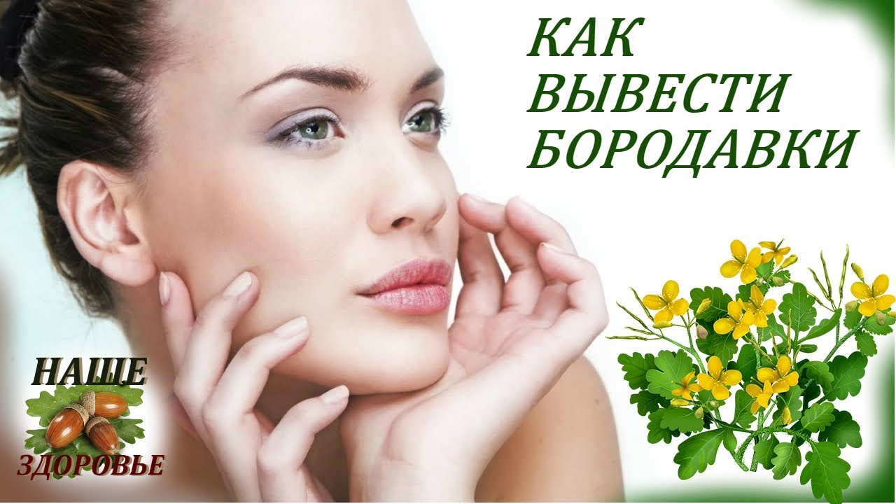 УДАЛЕНИЕ БОРОДАВОК☼ КАК ВЫВЕСТИ БОРОДАВКУ НАРОДНЫМИ СРЕДСТВАМИ - YouTube