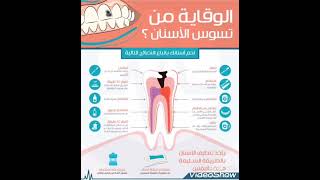 الوقاية من تسوس الأسنان