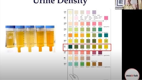 Urinary extracellular vesicles analysis and pre analytical variability by Luca Musante