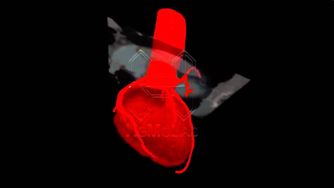 Coronary Segmentations