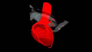 Famous Coronary Segmentations Wealth