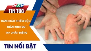 CẢNH BÁO NHIỄM ĐỘC THẦN KINH DO TAY CHÂN MIỆNG | HTV Tin Tức