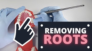 How To Extract Roots Covered By Soft Tissue | OnlineExodontia.com