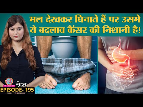 वीडियो: सेंसेट क्या है?