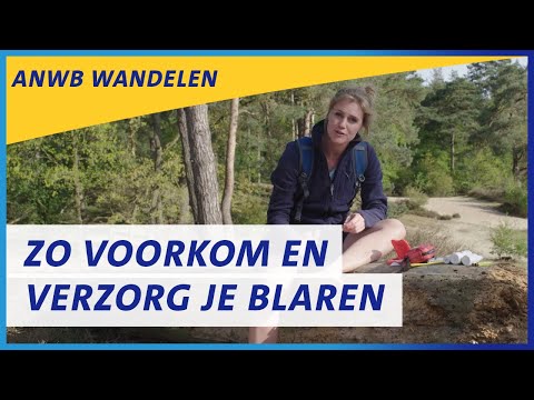 Video: Moleskin Voor Blaren: Hoe Het Te Gebruiken Om Blist Te Beschermen En Te Voorkomen