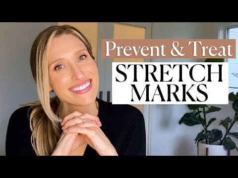 Can You Prevent Stretch Marks? A Dermatologist Explains Causes & Treatments | Dr. Sam Ellis