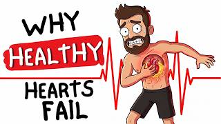 Why Healthy People Have Heart Attacks (3 Signs You're at Risk)
