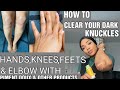 HOW TO CLEAR DARK KNUCKLES,FEETS,ELBOWS,KNEES with PIMENT DOUX & other LIGHTENING TUBES & serum